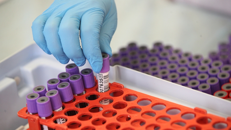 Ученые создали биодатчики для диагностики рака молочной железы за 20 минут